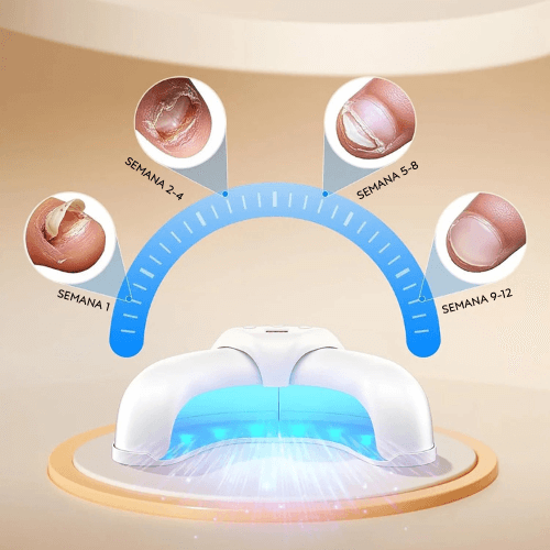 Dispositivo Laser para Tratamento de Unhas